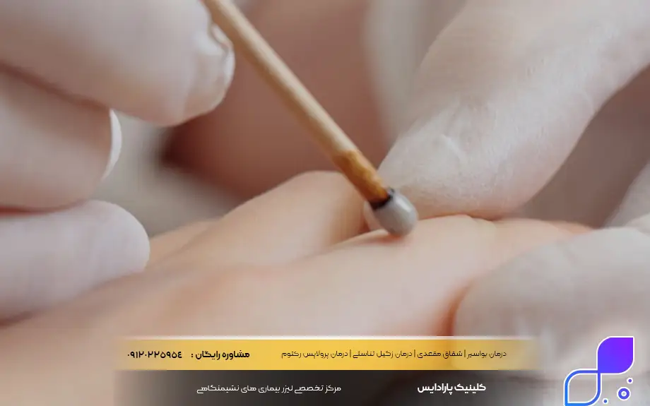 از کجا بفهمیم زگیل تناسلی داریم