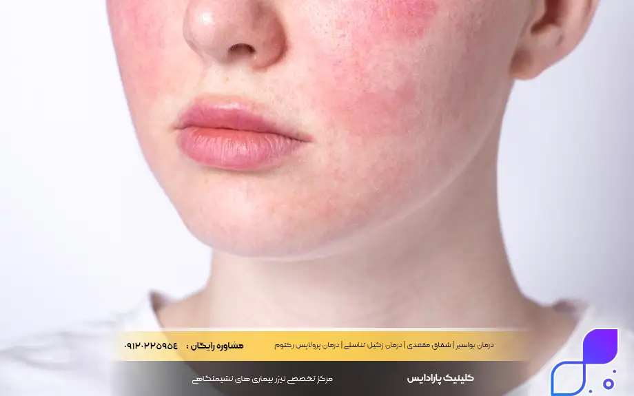 عوارض پماد هیدروکورتیزون