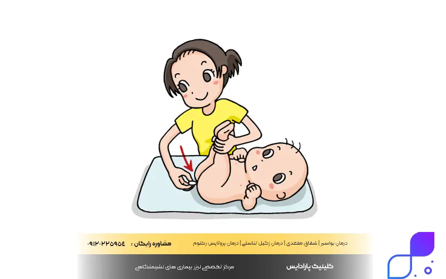 شیاف دیکلوفناک ۵۰ برای کودکان
