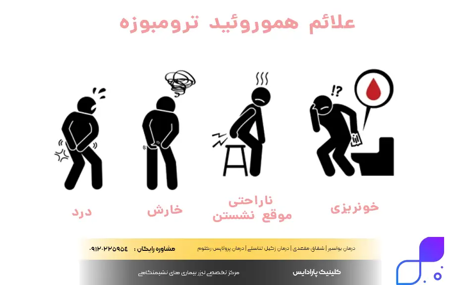 علائم هموروئید ترومبوزه