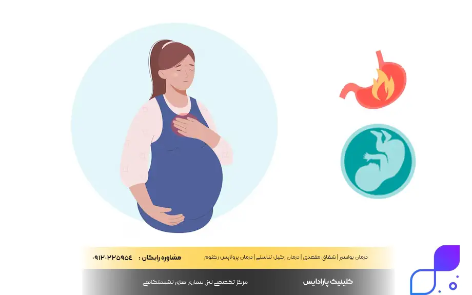 سوزش معده در بارداری