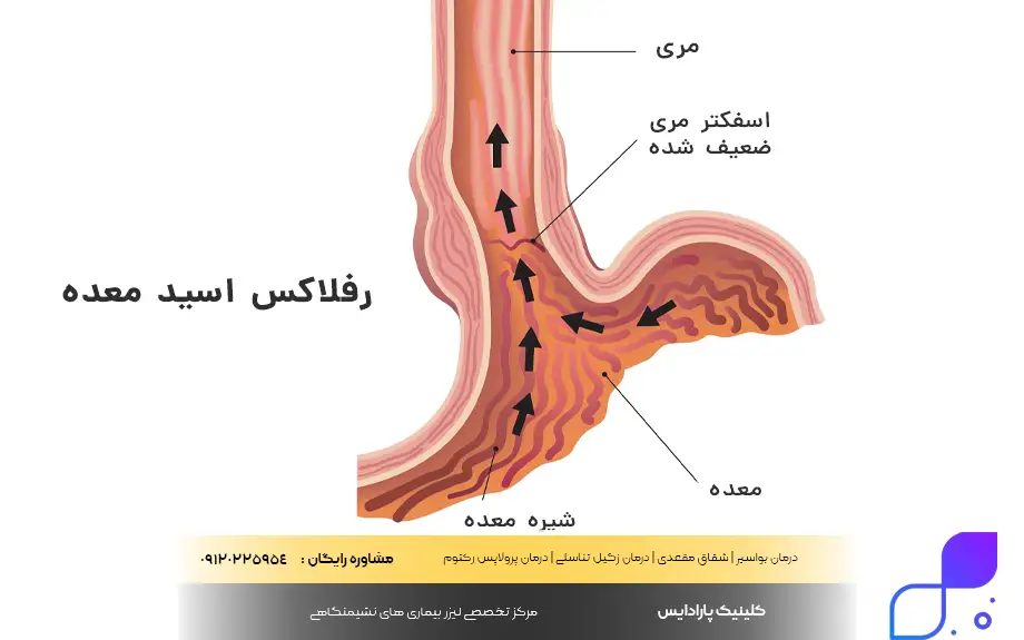 مشکلات و بیماریهای مرتبط با سوزش معده