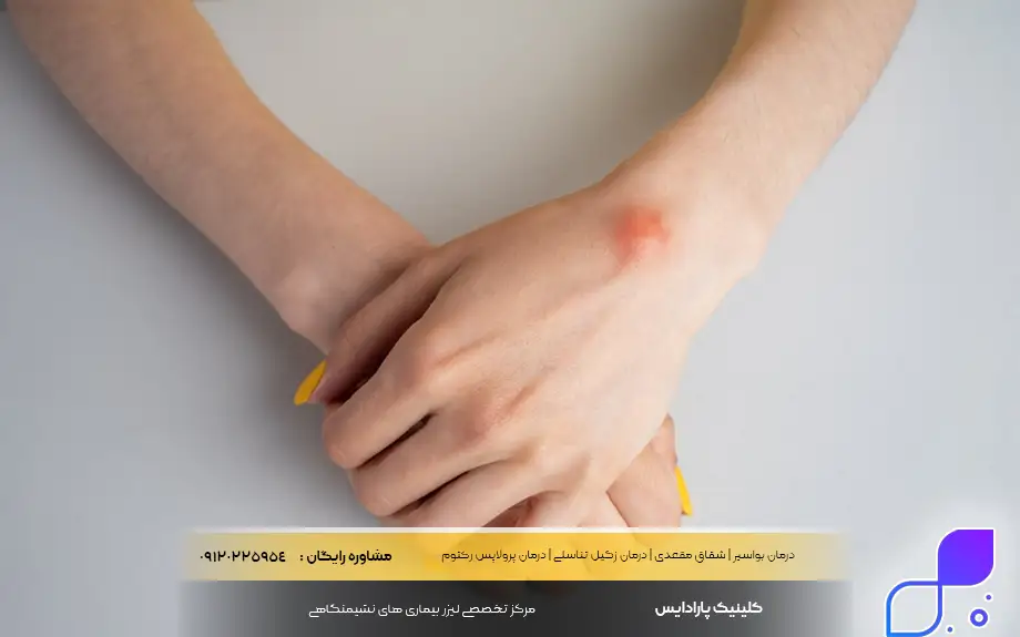 آیا غده چربی خطرناک است