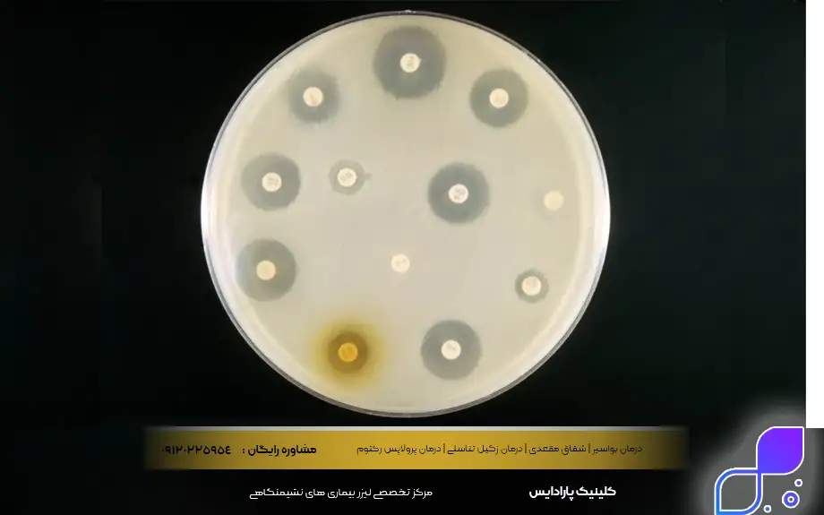 قرص آنتی بیوتیک