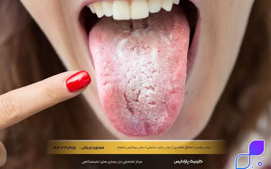 عوارض آنتیبیوتیکها