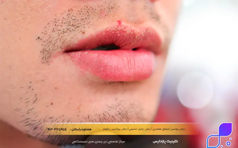 عکس فوردایس