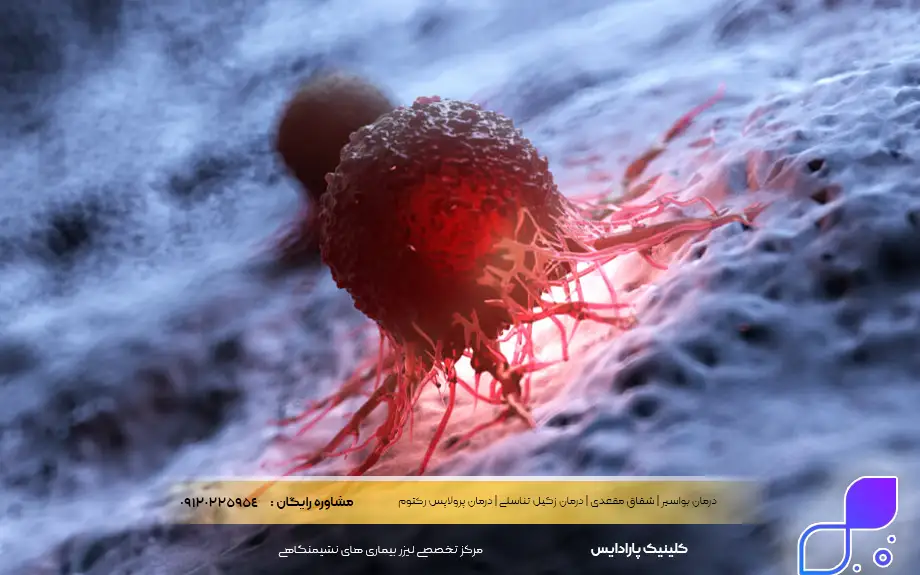 سرطان مقعدی چیست