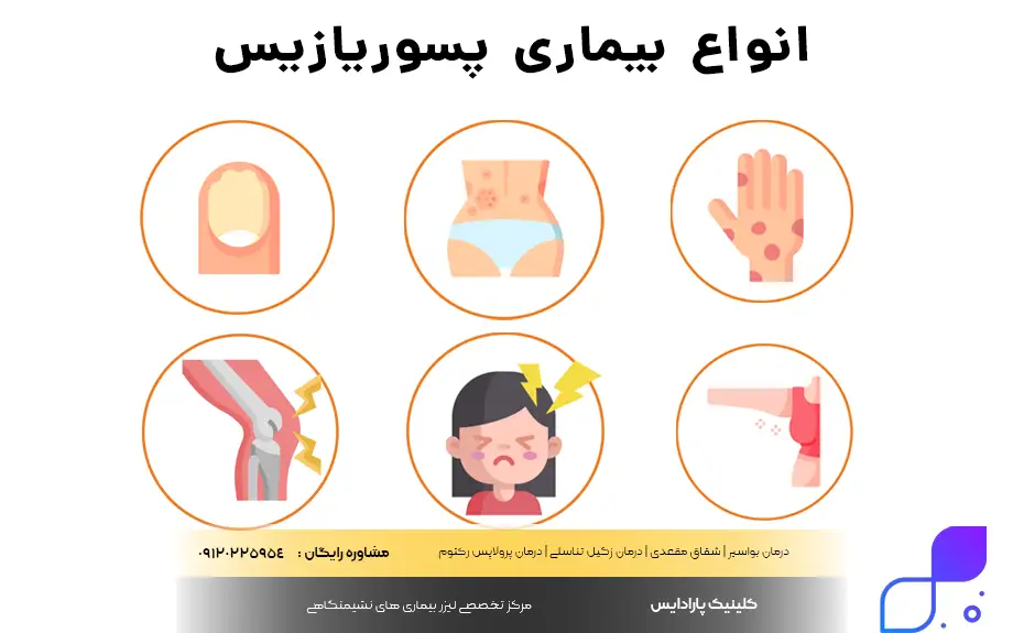 انواع بیماری پسوریازیس