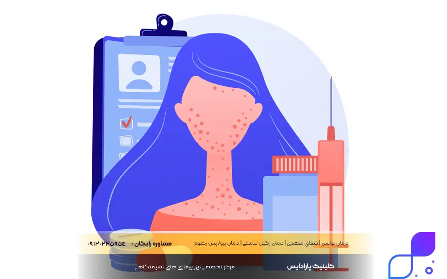 امپول برای درمان پسوریازیس