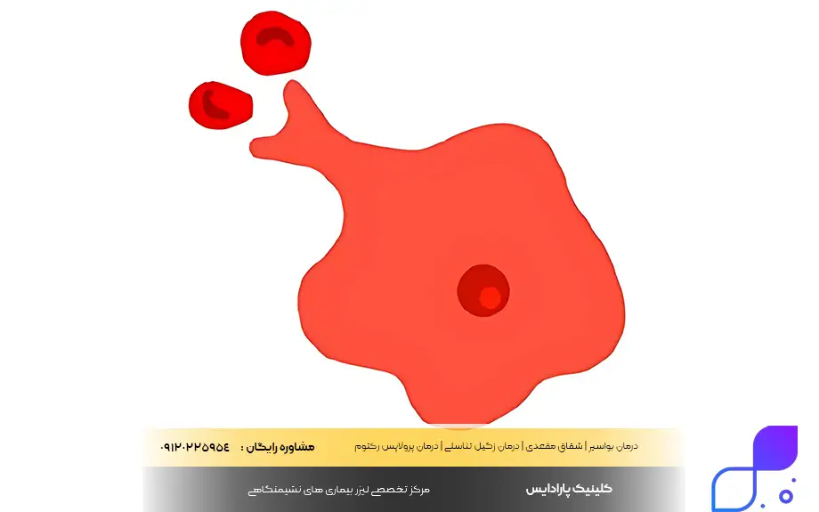 اسهال خونی چیست