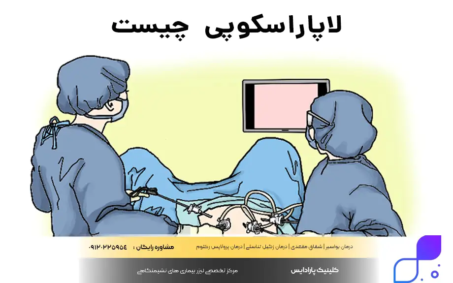 لاپاراسکوپی چیست