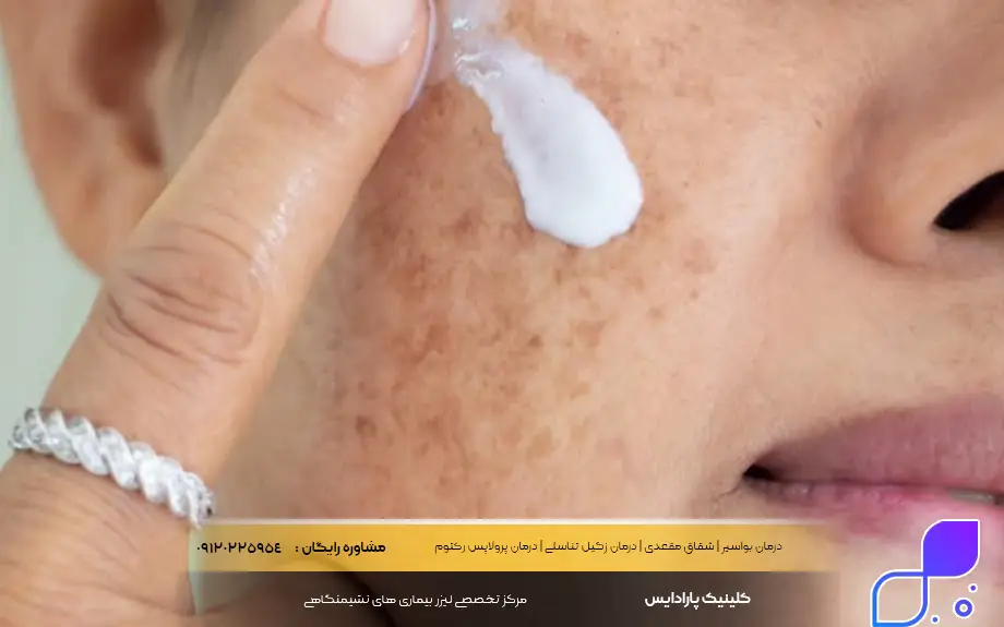 پماد موپیروسین برای لک صورت