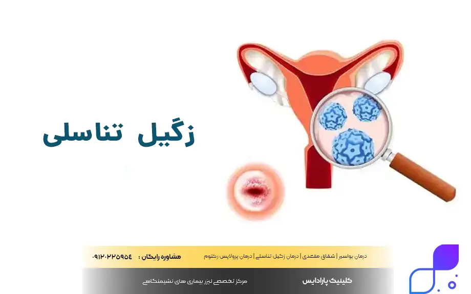 زگیل تناسلی چیست