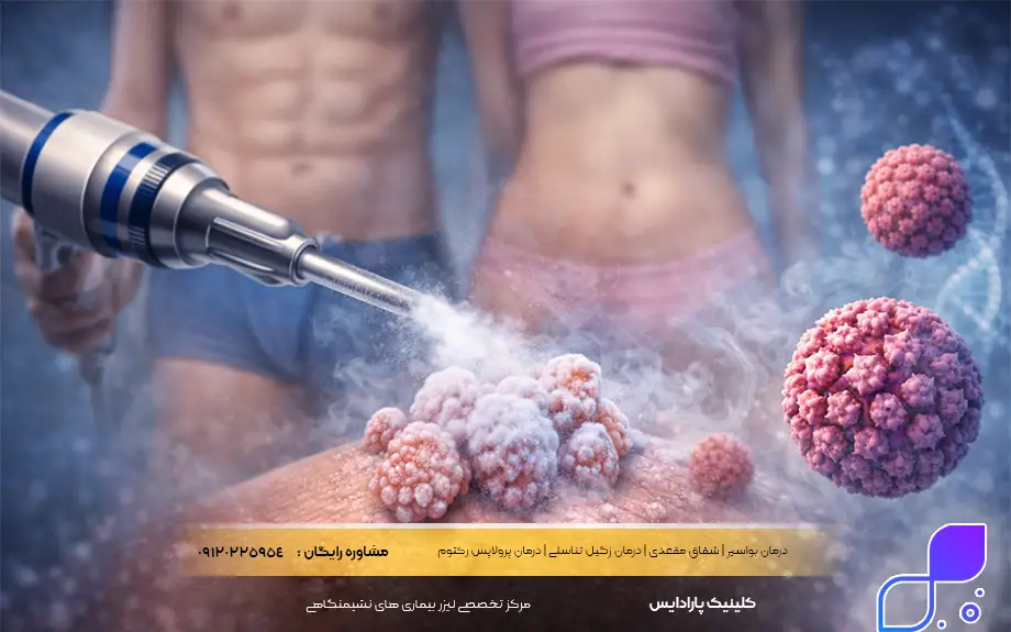 فریز یا کرایوتراپی