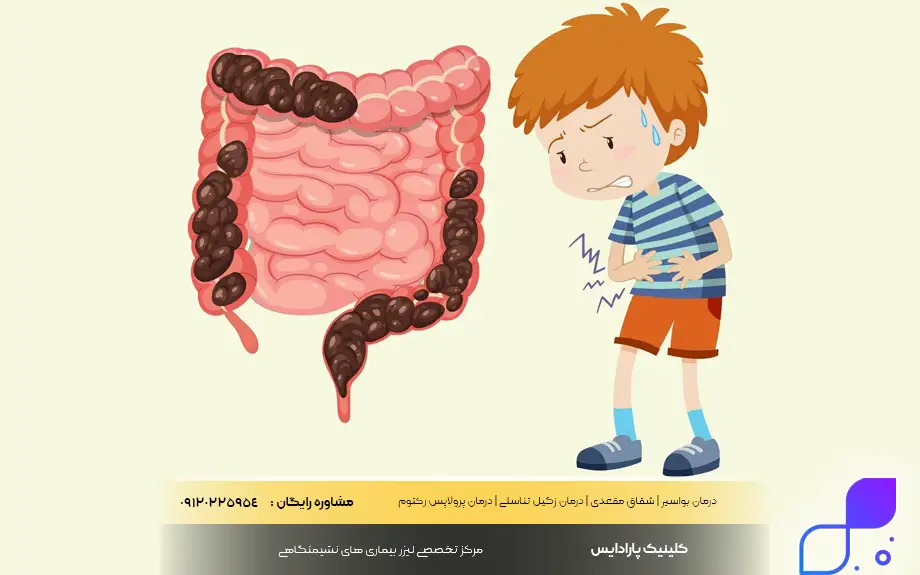 یبوست نوزاد 