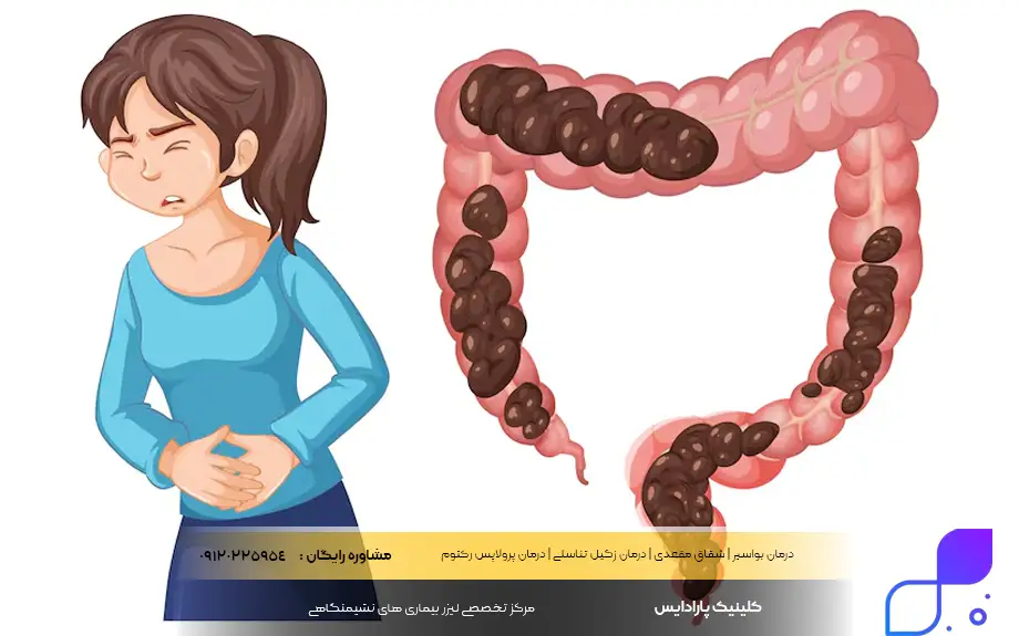 یبوست تا چند روز طبیعی است