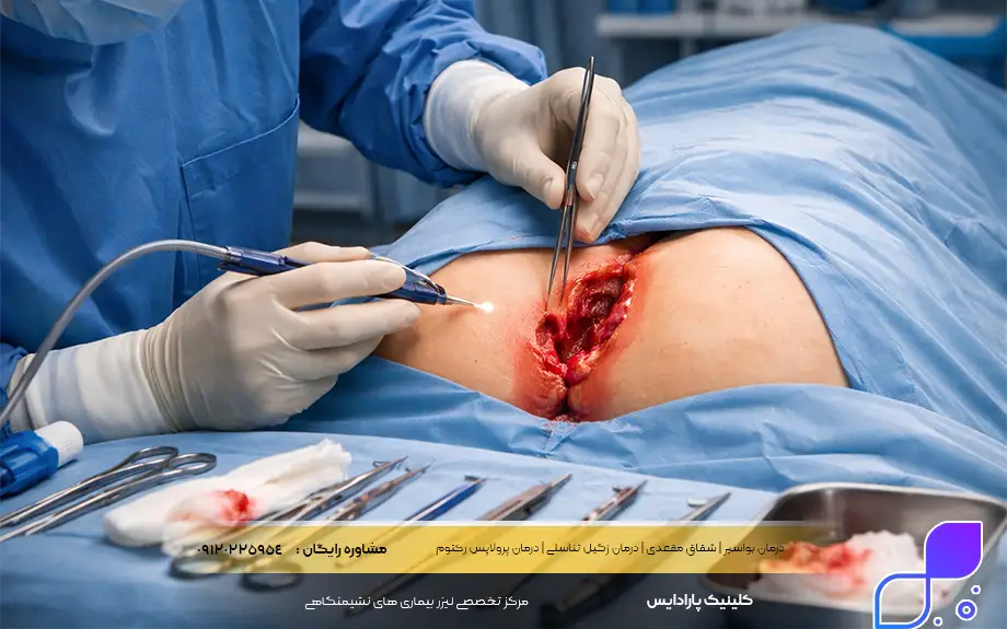 عمل کیست مویی